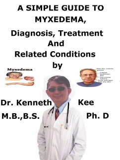 A Simple Guide to Myxedema, Diagnosis, Treatment and Related Conditions (eBook, ePUB) - Kee, Kenneth A Simple Guide to Myxedema, Diagnosis, Treatment and Related Conditions (eBook, ePUB) - Kee, Kenneth