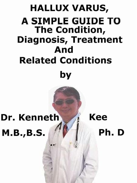 Hallux Varus, A Simple Guide To The Condition, Diagnosis, Treatment And Related Conditions (eBook, ePUB)