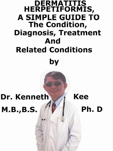 Dermatitis Herpetiformis, A Simple Guide To The Condition, Diagnosis, Treatment And Related Conditions (eBook, ePUB)