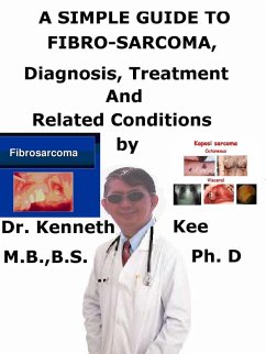 A Simple Guide to Fibro-sarcoma, Diagnosis, Treatment and Related Conditions (eBook, ePUB) - Kee, Kenneth A Simple Guide to Fibro-sarcoma, Diagnosis, Treatment and Related Conditions (eBook, ePUB) - Kee, Kenneth