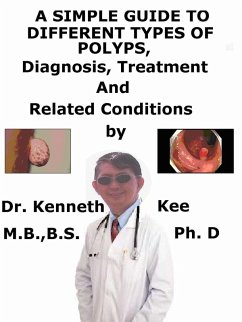 A Simple Guide to Different Types of Polyps, Diagnosis, Treatment and Related Conditions (eBook, ePUB) - Kee, Kenneth A Simple Guide to Different Types of Polyps, Diagnosis, Treatment and Related Conditions (eBook, ePUB) - Kee, Kenneth