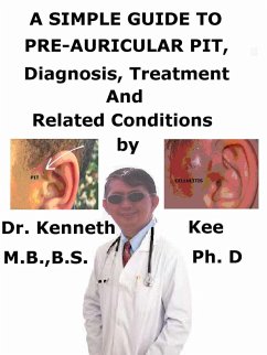 Cover A Simple Guide to Pre-auricular Pit, Diagnosis, Treatment and Related Conditions (eBook, ePUB)