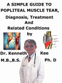 A Simple Guide to Popliteal Muscle Tear, Diagnosis, Treatment and Related Conditions (eBook, ePUB)