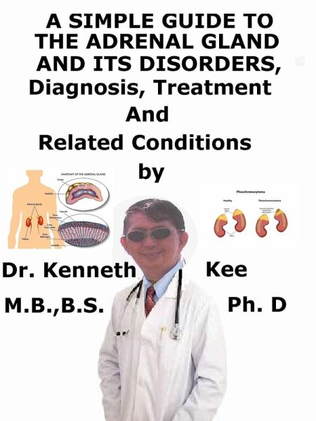 A Simple Guide to the Adrenal Gland and Its Disorders, Diagnosis, Treatment and Related Conditions (eBook, ePUB) A Simple Guide to the Adrenal Gland and Its Disorders, Diagnosis, Treatment and Related Conditions (eBook, ePUB)
