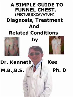 A Simple Guide to Funnel Chest (Pectus Excavatum), Diagnosis, Treatment and Related Conditions (eBook, ePUB) - Kee, Kenneth