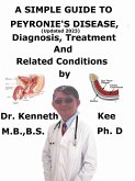 A Simple Guide to Peyronie's Disease, (Updated 2023) Diagnosis, Treatment and Related Conditions (eBook, ePUB)