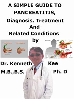 A Simple Guide to Pancreatitis, Diagnosis, Treatment and Related Conditions (eBook, ePUB) - Kee, Kenneth