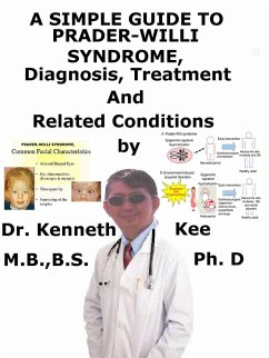A Simple Guide to Prader-Willi Syndrome, Diagnosis, Treatment and Related Conditions (eBook, ePUB) - Kee, Kenneth