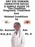 Dry Eye Disease, (Keratitis Sicca) A Simple Guide To The Condition, Diagnosis, Treatment And Related Conditions (eBook, ePUB)