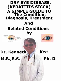 Dry Eye Disease, (Keratitis Sicca) A Simple Guide To The Condition, Diagnosis, Treatment And Related Conditions (eBook, ePUB) - Kee, Kenneth Dry Eye Disease, (Keratitis Sicca) A Simple Guide To The Condition, Diagnosis, Treatment And Related Conditions (eBook, ePUB) - Kee, Kenneth
