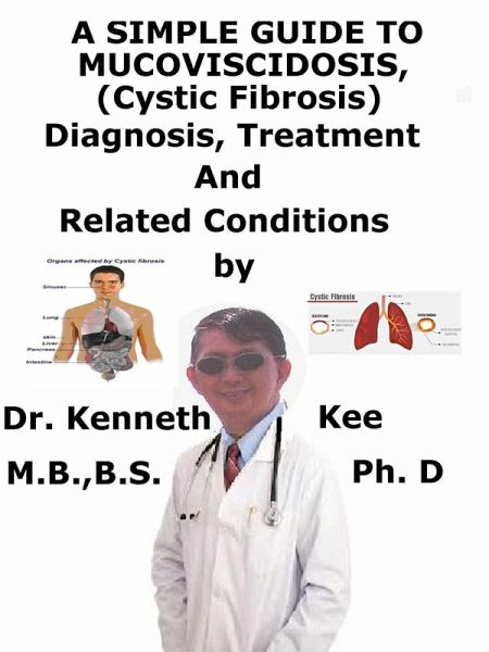 A Simple Guide To Mucoviscidosis (Cystic Fibrosis), Diagnosis, Treatment And Related Conditions (eBook, ePUB)