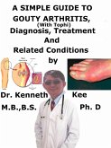 A Simple Guide to Gouty Arthritis (With Tophi), Diagnosis, Treatment and Related Conditions (eBook, ePUB)