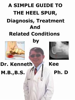 A Simple Guide to the Heel Spur, Diagnosis, Treatment and Related Conditions (eBook, ePUB) - Kee, Kenneth