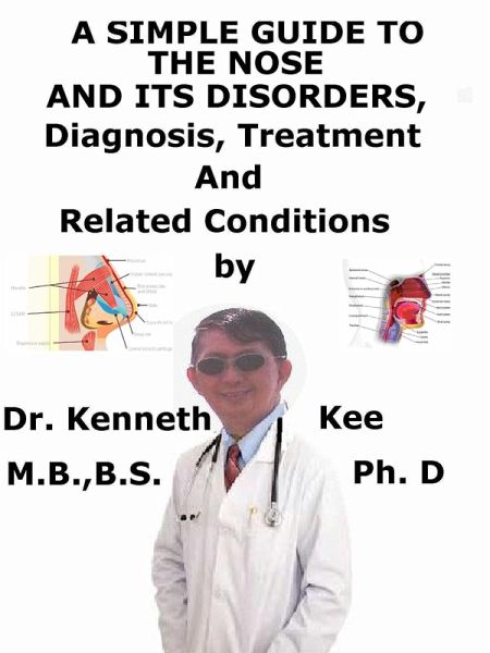A Simple Guide to the Nose and Its Disorders, Diagnosis, Treatment and Related Conditions (eBook, ePUB)