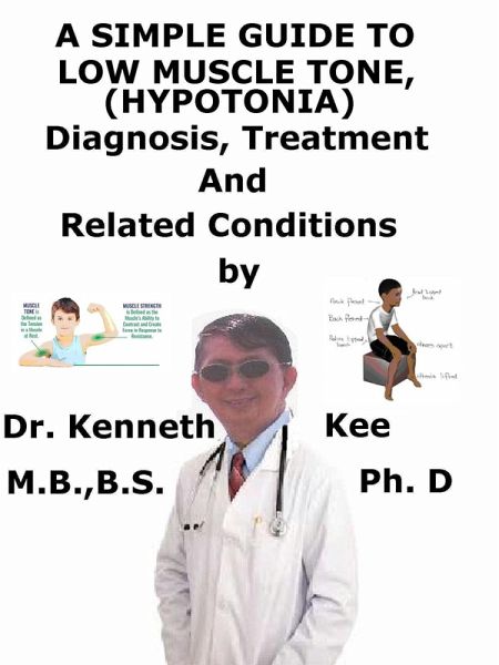 A Simple Guide to Low Muscle Tone (Hypotonia), Diagnosis, Treatment and Related Conditions (eBook, ePUB) A Simple Guide to Low Muscle Tone (Hypotonia), Diagnosis, Treatment and Related Conditions (eBook, ePUB)