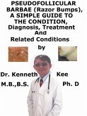 Pseudofolliculitis barbae (Razor Bumps), A Simple Guide To The Condition, Diagnosis, Treatment And Related Conditions (eBook, ePUB)