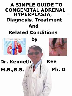 A Simple Guide to Congenital Adrenal Hyperplasia, Diagnosis, Treatment and Related Conditions (eBook, ePUB) - Kee, Kenneth A Simple Guide to Congenital Adrenal Hyperplasia, Diagnosis, Treatment and Related Conditions (eBook, ePUB) - Kee, Kenneth