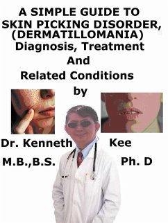 A Simple Guide to Skin Picking Disorder, (Dermatillomania) Diagnosis, Treatment and Related Conditions (eBook, ePUB) - Kee, Kenneth A Simple Guide to Skin Picking Disorder, (Dermatillomania) Diagnosis, Treatment and Related Conditions (eBook, ePUB) - Kee, Kenneth