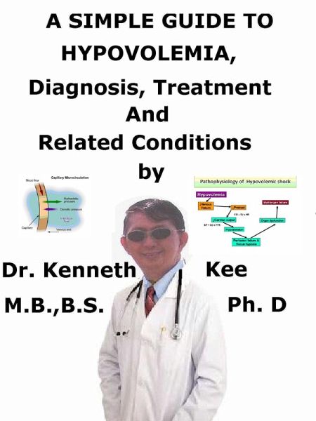 A Simple Guide to Hypovolemia, Diagnosis, Treatment and Related Conditions (eBook, ePUB) A Simple Guide to Hypovolemia, Diagnosis, Treatment and Related Conditions (eBook, ePUB)