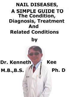 Cover Nail Diseases, A Simple Guide To The Condition, Diagnosis, Treatment And Related Conditions (eBook, ePUB)