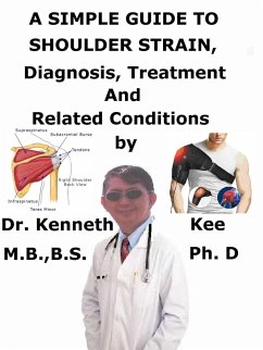 A Simple Guide to Shoulder Strain, Diagnosis, Treatment and Related Conditions (eBook, ePUB) - Kee, Kenneth