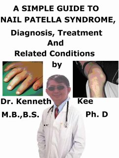 Cover A Simple Guide to Nail Patella Syndrome, Diagnosis, Treatment and Related Conditions (eBook, ePUB)