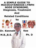 A Simple Guide to Mucocutaneous Lymph Node Syndrome (Kawasaki Disease), Diagnosis, Treatment and Related Conditions (eBook, ePUB)