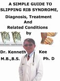 A Simple Guide to Slipping Rib Syndrome, Diagnosis, Treatment and Related Conditions (eBook, ePUB)