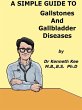 A Simple Guide to Gallstones and... - Bild 1