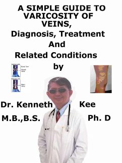 A Simple Guide to Varicosity of Veins, Diagnosis, Treatment and Related Conditions (eBook, ePUB) - Kee, Kenneth