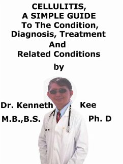 Cover Cellulitis, A Simple Guide To The Condition, Diagnosis, Treatment And Related Conditions (eBook, ePUB)