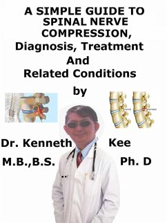 Cover A Simple Guide to Spinal Nerve Compression, Diagnosis, Treatment and Related Conditions (eBook, ePUB)