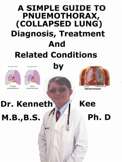 Cover A Simple Guide to Pneumothorax (Collapsed Lungs), Diagnosis, Treatment and Related Conditions (eBook, ePUB)