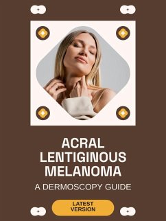 Cover Acral Lentiginous Melanoma (eBook, ePUB)