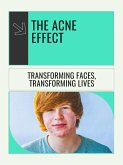 The Acne Effect (eBook, ePUB)