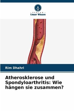 Cover Atherosklerose und Spondyloarthritis: Wie hängen sie zusammen?