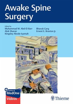 Cover Awake Spine Surgery (eBook, ePUB)