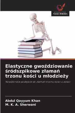 Cover Elastyczne gwo¿dziowanie ¿ródszpikowe z¿ama¿ trzonu ko¿ci u m¿odzie¿y