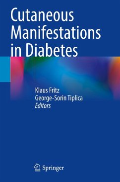 Cutaneous Manifestations in Diabetes
