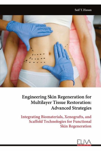 Engineering Skin Regeneration for Multilayer Tissue Restoration Engineering Skin Regeneration for Multilayer Tissue Restoration