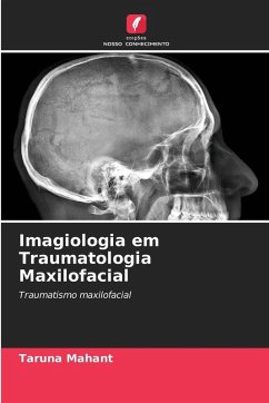 Imagiologia em Traumatologia Maxilofacial - Mahant, Taruna Imagiologia em Traumatologia Maxilofacial - Mahant, Taruna