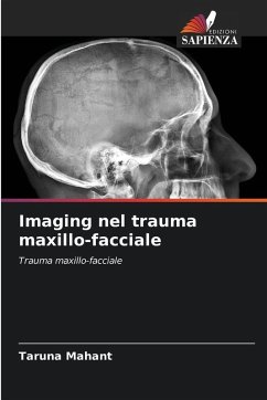 Imaging nel trauma maxillo-facciale - Mahant, Taruna Imaging nel trauma maxillo-facciale - Mahant, Taruna