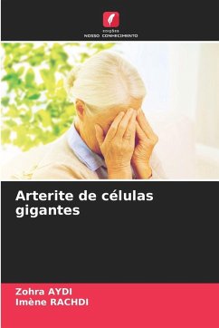 Arterite de células gigantes - Aydi, Zohra;Rachdi, Imene