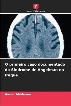 Cover O primeiro caso documentado de Síndrome de Angelman no Iraque