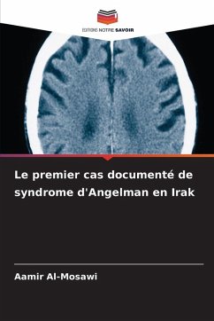 Cover Le premier cas documenté de syndrome d'Angelman en Irak