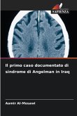 Il primo caso documentato di sindrome di Angelman in Iraq
