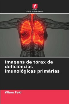 Imagens de tórax de deficiências imunológicas primárias - Feki, Wiem Imagens de tórax de deficiências imunológicas primárias - Feki, Wiem