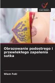 Obrazowanie podostrego i przewlek¿ego zapalenia sutka