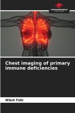 Chest imaging of primary immune deficiencies