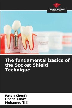 Cover The fundamental basics of the Socket Shield Technique